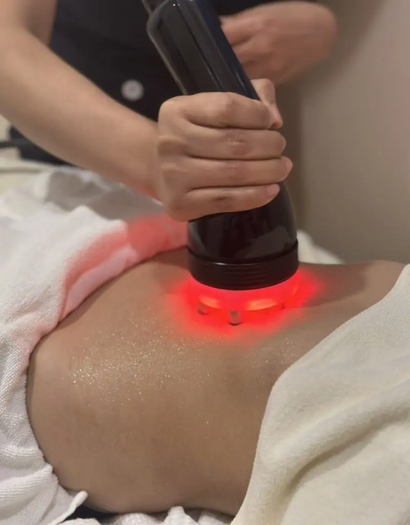 RF Fat Burn Treatment