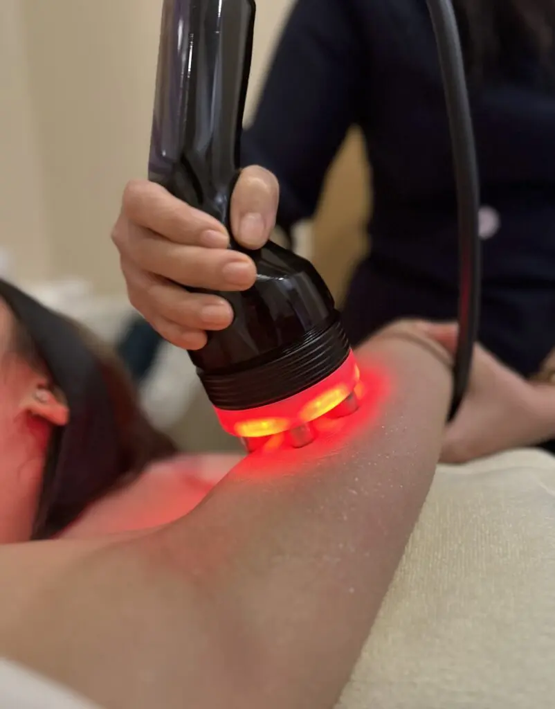 RF Arms Treatment