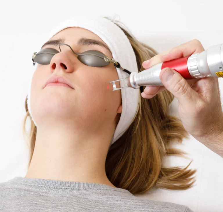 Example of a Pico laser facial treatment with eye protection